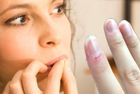 আপনি কি দাঁত দিয়ে নখ কাটেন, তাহলে এই মারাত্মক রোগে আক্রান্ত!