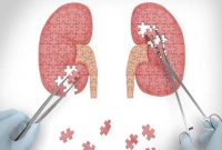 চার কিডনি নিয়ে এখনো বেঁচে আছেন ১৭ বছরের তরুণী!