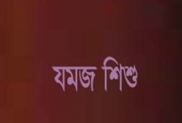 দুই মাথা এক শরীরে জন্ম নিল ভাই-বোন!