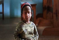 অবাক কান্ড, পাথরে পরিণত হচ্ছে এক শিশু