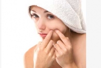 ব্রণ দুর করতে চান? জেনে নিন সহজ একটি উপায়