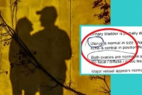 পুরুষ হয়ে গেল নারী! হতবাক চিকিৎসক