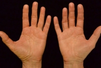 বিজ্ঞানসম্মতভাবে শুধু হাতের দিকে তাকিয়ে বুঝে নিন আপনি শারীরিকভাবে কতটা সুস্থ