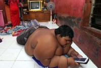 বয়স ১০, কিন্তু শিশুটির ওজন ১৯২ কেজি!