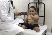 ১৮ মাসের শিশুর ওজন ২২ কেজি!