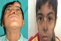 কপালে নাক, ঠিক জায়গায় আনলেন ডাক্তাররা!