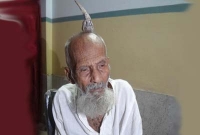 আল্লাহর কি কুদরত, বৃদ্ধের মাথায় গজিয়েছে শিং!