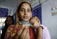  শিশুর গলায় জ্যান্ত মাছ!