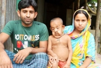 মাগুরার বৃদ্ধ শিশু বায়েজিদ এখন ঢামেকে