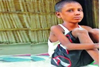 এবার এই শিশুর হাতে-পায়ে গজিয়েছে গাছের শেকড়