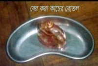পেটের ভেতর আস্ত কাচের বোতল!