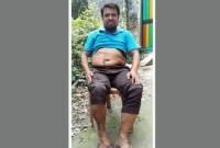 ২১ আগস্ট গ্রেনেড হামলায় গুরুতর আহত নাজিম উদ্দিন আজও শরীরে স্প্রিন্টার নিয়ে নিদারুন কষ্টে জীবন চালাচ্ছে