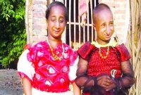 দিনে বাবার পিঠে এবাড়ি ওবাড়ি ঘুরে বেড়ায় ৩৩-৩৪ ইঞ্চির যুবতী দু’বোন!