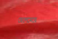 এক দেহে দুই মাথা বিশিষ্ট জমজ শিশুর জন্ম