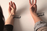 আপনার কবজি ভাঁজ করলে এই শিরাটি কি দেখা যায়? জেনে নিন কী এর অর্থ