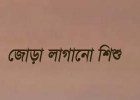 এক পায়ু পথ ও এক উরুতে জন্ম নিল দুই কন্যাশিশু!