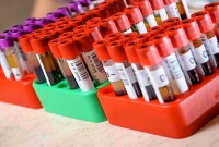 এই ৫টা ডাক্তারি পরীক্ষা করতে একদম ভুলে যাবেন না