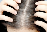  তাড়াতাড়ি চুল পেকে যাওয়া রোধ করে যে ৮টি খাবার