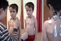 ‘চুম্বক বালক’ এর গায়ে লাগলেই আটকে যায় চামচ, কয়েন!