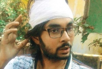 বোনের সম্মান বাঁচাতে গিয়ে মাথা ফাটলো ভাইয়ের বোনের সম্মান বাঁচাতে গিয়ে মাথা ফাটলো ভাইয়ের