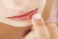 ঠোঁট ফাটা রোধ করার সহজ উপায়