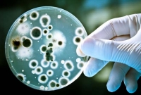 মৃত্যুর সময় জানা যায় শরীরের ব্যাকটেরিয়ার কাছ থেকে