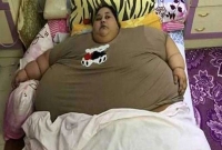 বিশ্বের সবচেয়ে মোটা নারীকে সুস্থ করার জন্য যেসব পদক্ষেপ নিয়েছে ডাক্তাররা