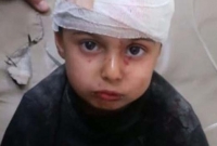 সিরিয়ায় ধ্বংসস্তুপ থেকে বেঁচে ফিরলো ফুটফুটে শিশু