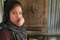 অজানা রোগে আক্রান্ত তমার অনিশ্চিত ভবিষ্যৎ নিয়ে শংকিত বাবা-মা