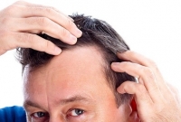 ঘরোয়া চিকিৎসায় মাথায় চুল গজাবে ম্যাজিকের মতো!