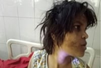 কথা বলতে শুরু করেছে ভারতের ‘বানর-কন্যা’