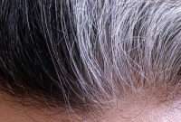 টাক পড়া এবং চুল সাদা হয়ে যাওয়ার জন্য দায়ী কোষকে শনাক্ত করেছেন বিজ্ঞানীরা