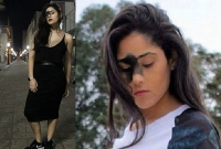  'বিদঘুটে' জন্মদাগই তাকে বানিয়েছে অনন্যা-অপরূপা