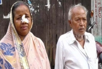 শাশুড়িকে মেরে নাক ফাটিয়ে দিলেন পুত্রবধূ