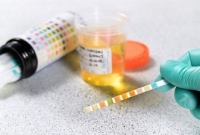 বিএনপির ছাত্রনেতা হবার জন্য মূত্র পরীক্ষা!