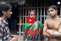 সাতক্ষীরার রাজীবও অজানা রোগে আক্রান্ত