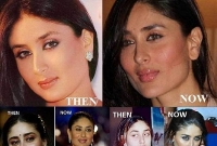 বলিউডের এই ৫ নায়িকা তাদের সৌন্দর্য ধরে রেখেছে প্লাস্টিক সার্জারির মাধ্যমে