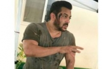আহত সালমান খানের রক্তাক্ত ছবি ভাইরাল !