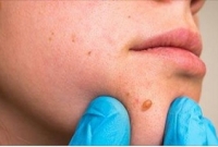  এই তিলগুলি দেখে বুঝবেন আপনার ভাগ্য বদলাতে পারে, কিন্তু বিয়ের পরে...