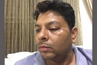 ‘আজ আমি গরিব বলে অভিনয় শিল্পীরা আমাকে অন্যায়ভাবে মারলো’