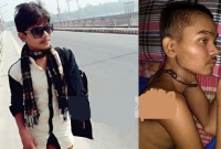 চিকিৎসার অভাবে মাংস খসে পড়ছে ক্ষুদে ফুটবলার বুলেটের!