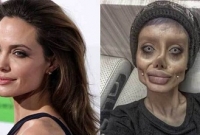 বিশ্বসেরা নায়িকা জোলির মতো হতে গিয়ে দেখুন কী অবস্থা হলো এ তরুণীর!