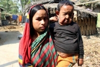  বিরল রোগে আক্রান্ত সেই ‘বৃদ্ধ শিশু’ আর নেই