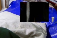 হোটেলে যেতে রাজি না হওয়ায় প্রেমিকাকে কুপিয়ে জখম হোটেলে যেতে রাজি না হওয়ায় প্রেমিকাকে কুপিয়ে জখম