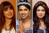 অপারেশন করে রূপ বদলেছেন যে তারকারা