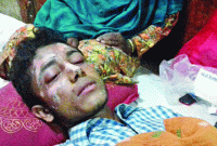 প্রেমের প্রস্তাবে রাজি না হওয়ায় এসিড মেরে মুখ ঝলসে দিয়েছে ছাত্রী