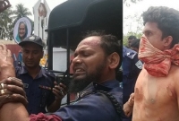 চড় মারায় ক্ষুদ্ধ পান দোকানদারের ক্ষুরের আঘাতে তিন পুলিশ আহত!