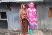 স্কুলে যেতে চায় দুলিয়া, মেয়ের চিকিৎসায় সহায়তা চান বাবা