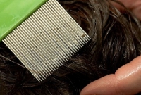 দুবাইতে চড়া দামে বিক্রি হচ্ছে উকুন! বাংলাদেশি টাকায় প্রতিটি উকুনের মূল্য..