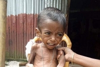 বাসা বেঁধেছে অজানা রোগ